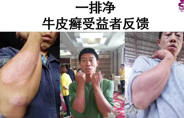 皮肤问题